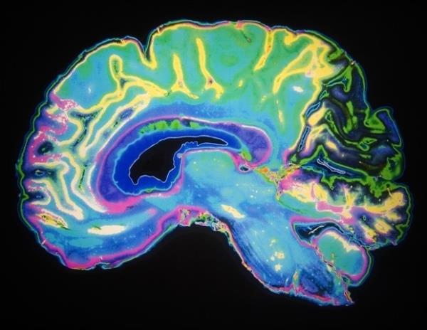 克莱姆森大学的研究生专注于研究基因如何在正常大脑中相互作用